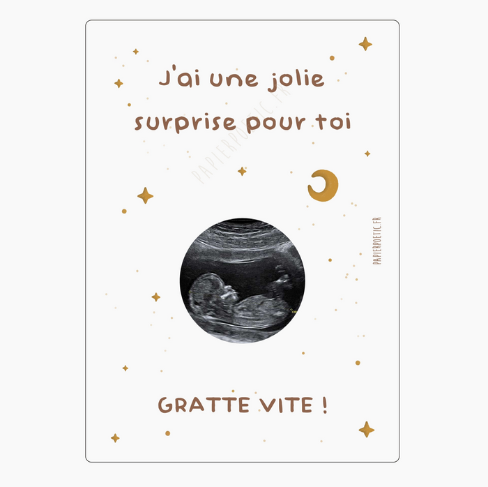 Carte à gratter échographie | Ciel étoilé